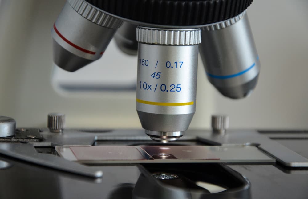 Missed by the Microscope: Why Traditional Diagnostics Are Failing to Detect Tapeworm and Whipworm in Dogs and How to Fix It Missed by the Microscope: Why Traditional Diagnostics Are Failing to Detect Tapeworm and Whipworm in Dogs and How to Fix It