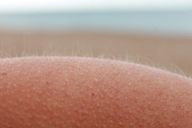 All About Dog Hackles Great Pet Care